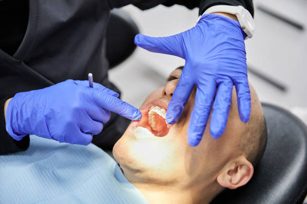 Best Emergency Dental Extractions in Newport, TN