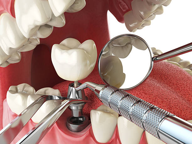 Best Broken or Cracked Tooth Emergency Dentist in Newport, TN